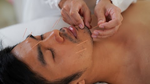 Acupuncture Sheffield @ The Sheffield Clinic of Complementary Medicine