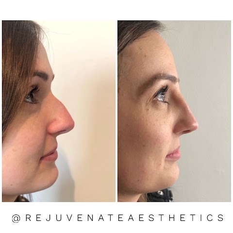 Rejuvenate Aesthetics Clinic - Nurse Prescriber Led Medical Clinic in Southampton