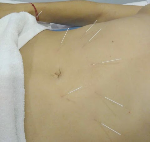 MOXAY Acupuncture Wellbeing Clinic