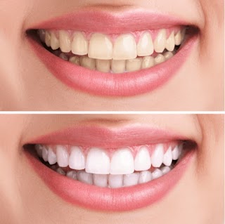 Smile Dental Implants