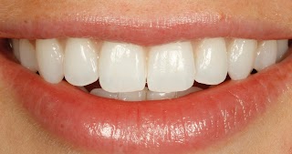 Dr Tom Lotka - Invisalign Sheffield