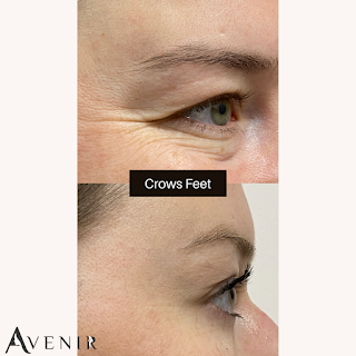 Avenir Clinics