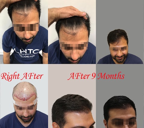 London Hair Transplant Clinic