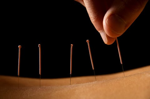 The Acupuncture clinic