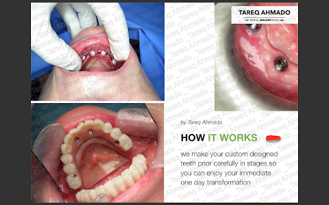Tareq Ahmado - Master Sci in Dental Implants