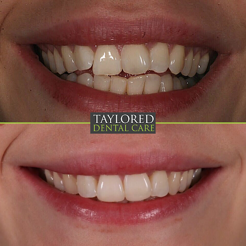 Taylored Dental Care Idle