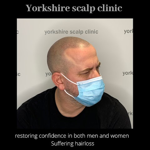 Yorkshire scalp clinic