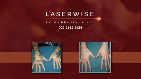 LaserWise Clinic