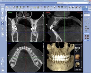 Стоматологія «АйДент» (Ювілейна)