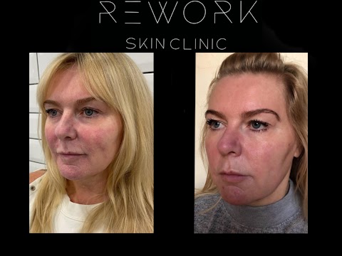 ReWork Skin Clinic