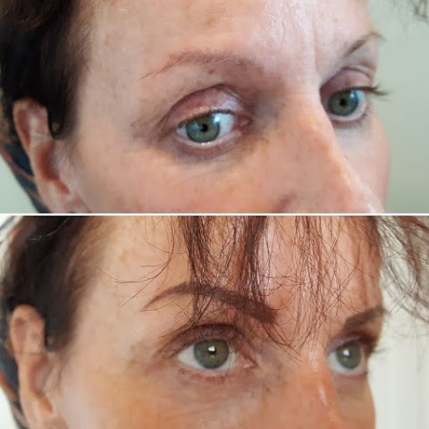 Redeem Clinic Microblading & Scalp micropigmentation