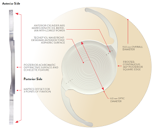 The Berkshire Eye Clinic - a centre of excellence in Cataract and Retinal Surgery