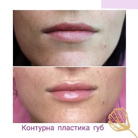 Косметолог Івано Франківськ Студія краси B.V.B.Cosmetic