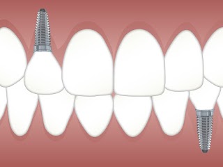 Thanet House Dental Care