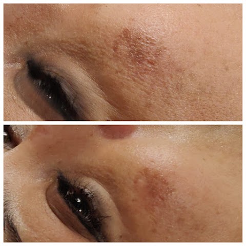 Nova Skin & Laser Clinic