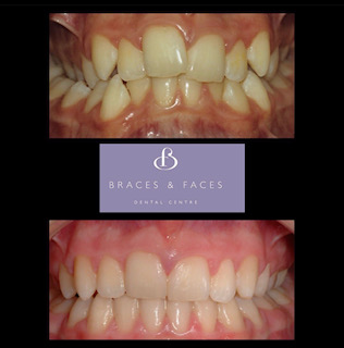 Braces & Faces Dental Centre