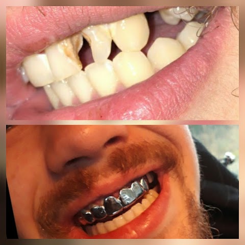 PETER GRILLS . NO1 GOLD GRILLS SPECIALIST