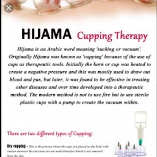 Hijama specialists cupping