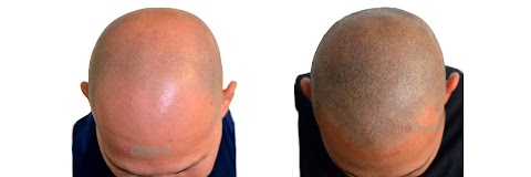 Redeem Microblading & Scalp micropigmentation, Leeds