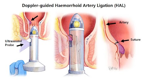 Warwickshire Nuffield Bowel & Hernia Clinic