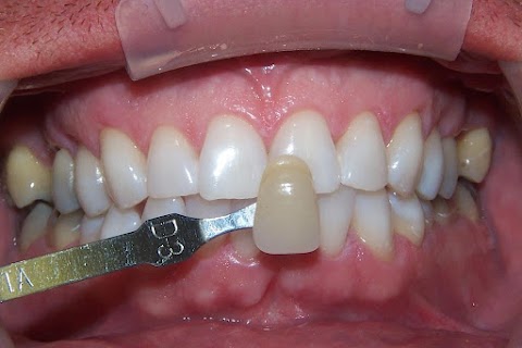 Higher Lane Dental Practice