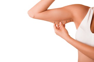 London Liposuction Clinic