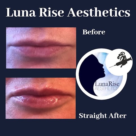 Luna Rise Aesthetics