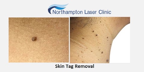 Northampton Laser Clinic