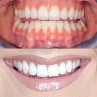 Perfect Smile Dental - Wallasey