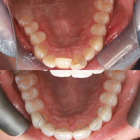 Dental22