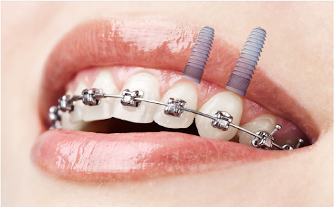 Clinic for Implant & Orthodontic Dentistry