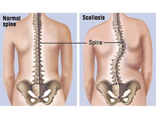 Cardiff Spinal Clinic