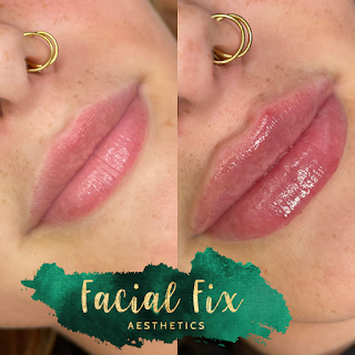 Facial Fix Aesthetics