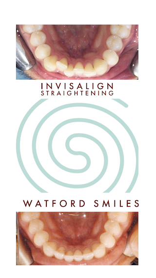 Watford Smiles Invisalign