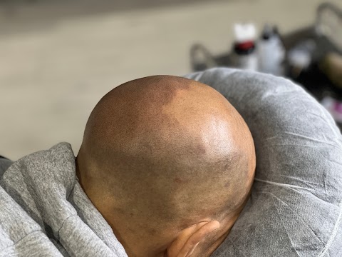 Hair Savvy Studio - Scalp Micropigmentation Clinic