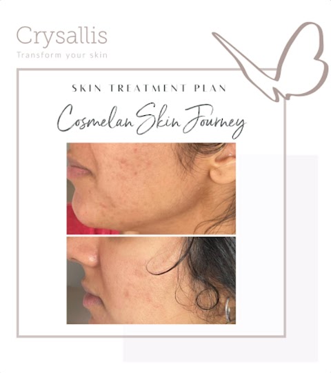 Crysallis Skin Clinic