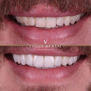 Vogue Dental