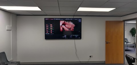 4D 3D Baby Scanning Hamilton