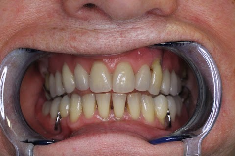 Active Dental Denture Clinic