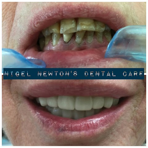 Nigel Newton's Dental Care