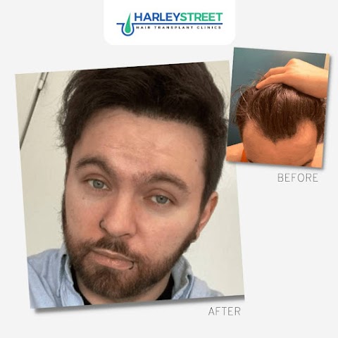 Sheffield Hair Transplant Clinic