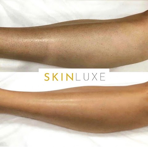 SkinLuxe Clinic Manchester