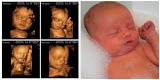 Ultrasound Direct Southampton - Babybond