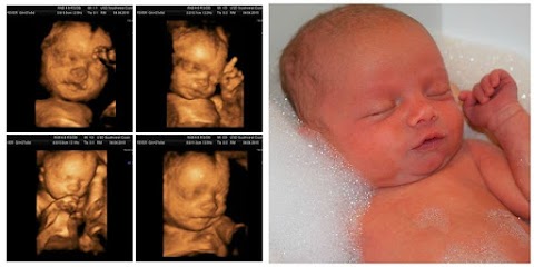 Ultrasound Direct Southampton - Babybond