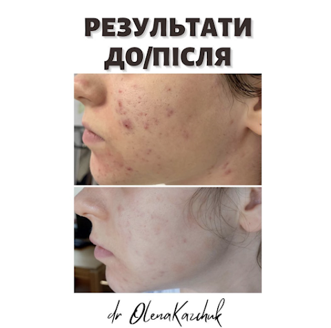 Дерматологічний центр краси dr.Olena Kazchuk