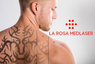 La Rosa Medlaser | Удаление Тату И Татуажа