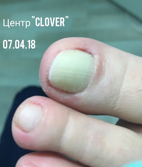 Центр "Clover" Подологія, Косметологія, Подіатрія