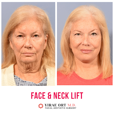 photo of Yirae Ort MD Facial Aesthetic Surgery