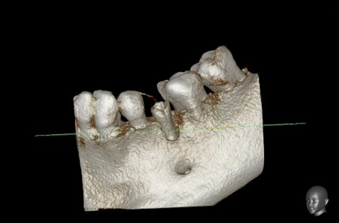 3D КТ в Житомирі