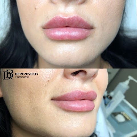 Berezovskiy Cosmetology Дмитрия Березовского